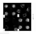 Fig. 10 - Method of detection of volatile organic compounds using liquid crystals that form a blue phase; and device for stabilization and thickness control of liquid crystal films