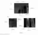 Fig. 14 - Test strips for visual differentiation of liquid mixture composition