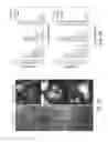 Fig. 12 - THREE-DIMENSIONAL TRANSGLUTAMINASE-CROSSLINKED HYDROGEL FOR TUMOR ENGINEERING