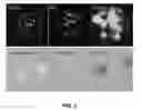 Fig. 08 - 3D TISSUE MODEL FOR SPATIALLY CORRELATED ANALYSIS OF BIOCHEMICAL, PHYSIOLOGICAL AND METABOLIC MICRO-ENVIRONMENTS