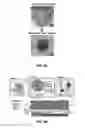 Fig. 11 - 3D TISSUE MODEL FOR SPATIALLY CORRELATED ANALYSIS OF BIOCHEMICAL, PHYSIOLOGICAL AND METABOLIC MICRO-ENVIRONMENTS