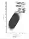 Fig. 09 - System and method for identification and characterization of transglutaminase species