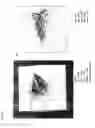 Fig. 15 - System and method for analyzing tissue for the presence of cancer using bio-marker profiles