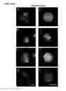 Fig. 03 - METHODS FOR PREDICTING OVERALL SURVIVAL OF CANCER PATIENTS BASED ON NUMBERS OF CIRCULATING TUMOR CELLS
