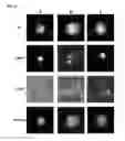 Fig. 06 - METHODS FOR PREDICTING OVERALL SURVIVAL OF CANCER PATIENTS BASED ON NUMBERS OF CIRCULATING TUMOR CELLS