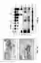 Fig. 03 - METHODS FOR DIAGNOSING AND TREATING INFLAMMATORY BOWEL DISEASE