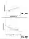 Fig. 44 - METHODS FOR DETECTING AMYLOID BETA AMYLOIDOSIS