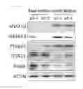 Fig. 11 - Marker for detecting proliferation and treatment capacities of adipose-derived stem cell cultured in medium containing EGF or BFGF, and use thereof