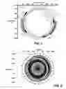 Fig. 02 - Multi-vessel coil shooting acquisition