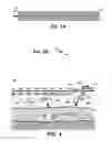 Fig. 04 - Multi-vessel coil shooting acquisition