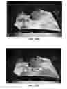 Fig. 10 - Multi-vessel coil shooting acquisition