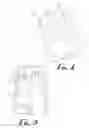 Fig. 04 - Gesture configurable floating soft trigger for touch displays on data-capture electronic devices