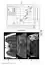 Fig. 05 - Decision support tool for stroke patients