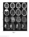 Fig. 09 - Decision support tool for stroke patients