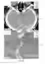 Fig. 10 - Decision support tool for stroke patients