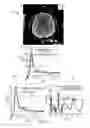 Fig. 13 - Decision support tool for stroke patients
