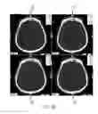 Fig. 14 - Decision support tool for stroke patients
