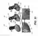Fig. 26 - Systems and methods for determining blood flow characteristics using flow ratio