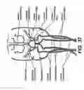 Fig. 31 - Systems and methods for determining blood flow characteristics using flow ratio