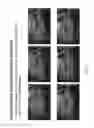 Fig. 04 - Vehicle vision system with 3D registration for distance estimation