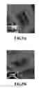 Fig. 10 - Non-dyadic lens distortion correction method and apparatus