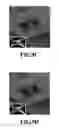 Fig. 11 - Non-dyadic lens distortion correction method and apparatus