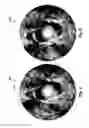 Fig. 05 - Seam elimination and motion compensation in imaging data