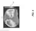 Fig. 08 - QUANTITATIVE METHOD FOR 3-D JOINT CHARACTERIZATION