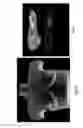 Fig. 04 - Ultrasound phantom models, materials, and methods