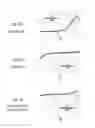 Fig. 17 - Vector noise cancellation
