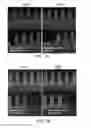 Fig. 09 - INTERNAL PLASMA GRID FOR SEMICONDUCTOR FABRICATION
