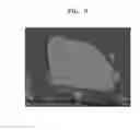 Fig. 07 - Negative active material and lithium battery including negative active material