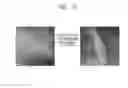 Fig. 14 - Negative active material and lithium battery including negative active material