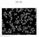 Fig. 10 - Positive active material for rechargeable lithium battery, method of preparing same and rechargeable lithium battery including same
