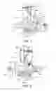 Fig. 05 - Side-loading straight-line deadend clamp assembly