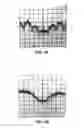 Fig. 05 - Channelized active noise elimination (CANE) for bit stream RF transmitters