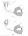 Fig. 02 - Hands-Free Electronic Device Holder