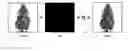Fig. 01 - Defocus estimation method independent of the scene content and use in an autofocus system