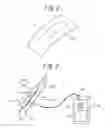 Fig. 03 - Acoustic device