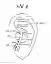 Fig. 04 - Acoustic device