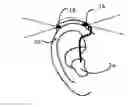 Fig. 01 - HEARING DEVICE WITH IMAGE CAPTURE CAPABILITIES