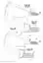 Fig. 02 - Method and apparatus for coil alignment in electromagnetic hearing implant