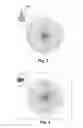 Fig. 04 - Lighting device and luminaire comprising an integrated antenna
