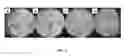 Fig. 04 - MICROBIAL COMPOSITIONS FOR USE IN COMBINATION WITH SOIL INSECTICIDES FOR BENEFITING PLANT GROWTH