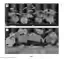 Fig. 05 - BACILLUS LICHENIFORMIS RTI184 COMPOSITIONS AND METHODS OF USE FOR BENEFITING PLANT GROWTH