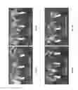 Fig. 11 - BACILLUS AMYLOLIQUEFACIENS RTI472 COMPOSITIONS AND METHODS OF USE FOR BENEFITING PLANT GROWTH AND TREATING PLANT DISEASE