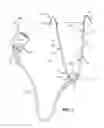 Fig. 02 - Game dressing tool