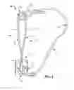 Fig. 03 - Game dressing tool