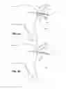 Fig. 05 - Game dressing tool