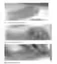 Fig. 03 - METHOD FOR SLICING TENDERS